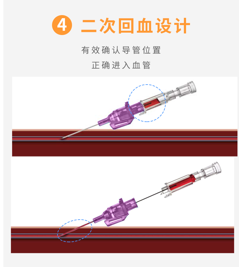 英全康20G動靜脈留置針